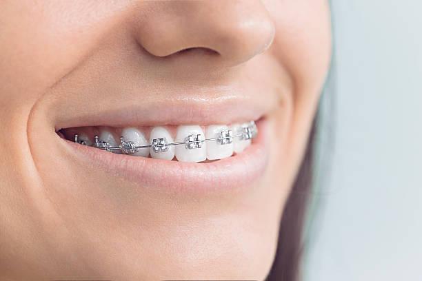 Why Choose Us for Your Dental Needs in Moon Lake, FL